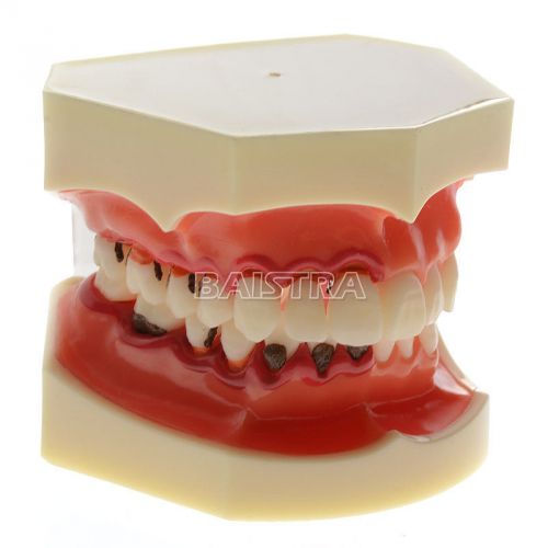 Dental Teeth Model for Dentist Use FREE SHIP