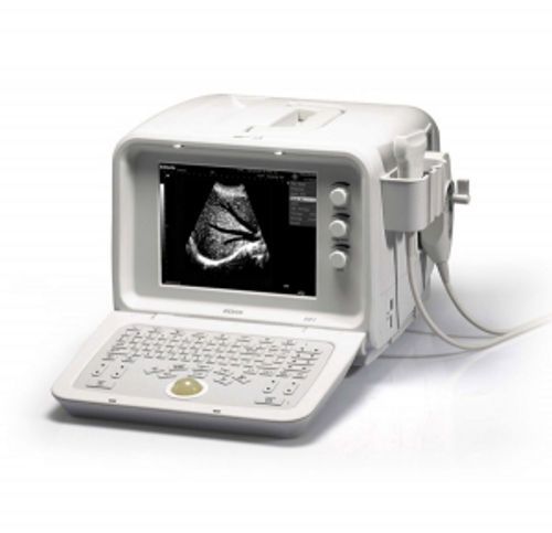 Edan DUS 3 Digital Ultrasonic Diagnostic Imaging System - Brand New