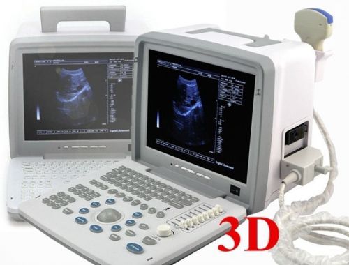 Digital Laptop Ultrasound Scanner+Convex+ Transvaginal Probe+ external Factory!!