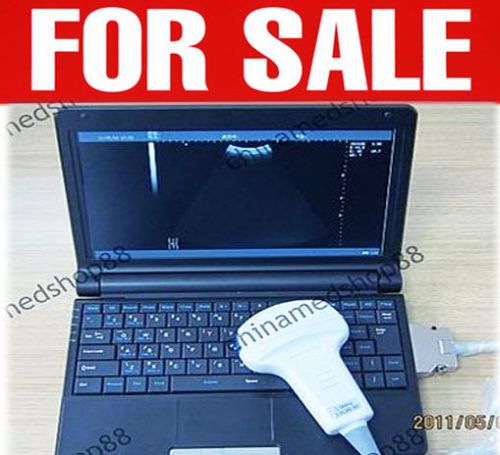 2015 HOT Digital Laptop/notebook 10.1 inch Ultrasound Scanner +Convex FDA&amp;CE