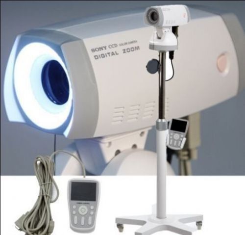 Ca digital electronic colposcope gynecologic exam sony camera 830,000 pixel-5a+ for sale