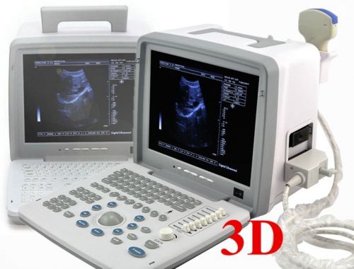 FactoryDigital Laptop Ultrasound Scanner+Convex+ Transvaginal Probe+ external 3D