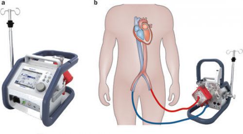 Cardiohelp ECMO Disposable Kit Maquet