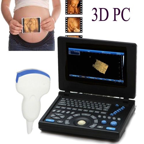 High-resolution color full digital laptop ultrasound scanner pc convex probe 3d for sale