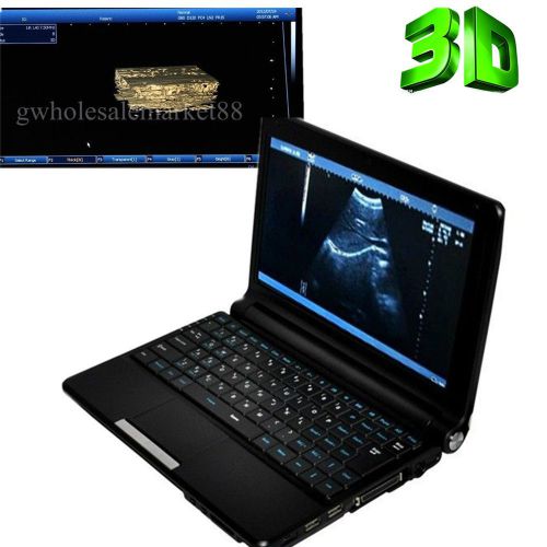 +3d Full Digital Laptop Ultrasound Scanner Machine + Convex Probe USB NEW
