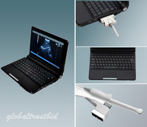 Digital Laptop/Notebook Ultrasound scanner Machine System +6.5Mhz Trans-vaginal