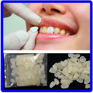 Aritifical Sental-Porcelain Whitening Veneers Resin Teeth Upper Anterior Shade
