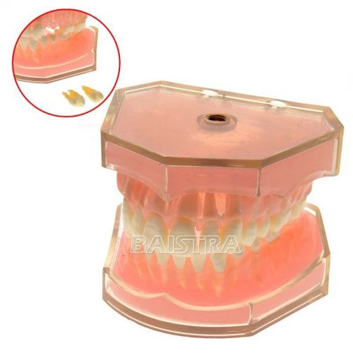 Dental Teeth Study Teach Model Standard Teeth Model Removable 4004 FREE SHIPPING