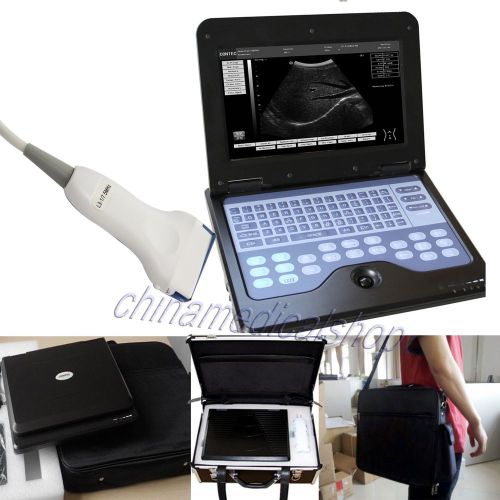 Hot 2014 new software full digital laptop ultrasound scanner with linear probe for sale