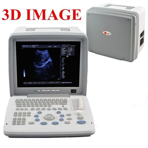 12.1in digital laptop ultrasound scanner+convex+ transvaginal probe+ external 3d for sale