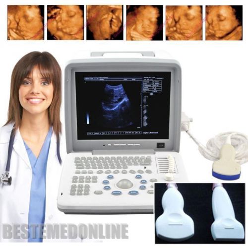 Portable digital ultrasound scanner machine + convex + linear probe +3d bid bid for sale
