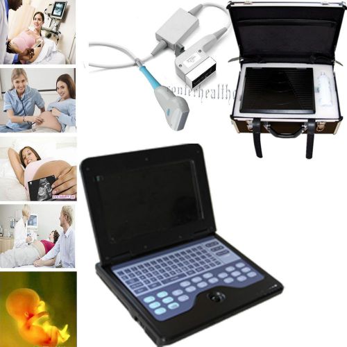 High resolution! linear portable B-Ultrasound Diagnostic Scanner+linear Probe P2