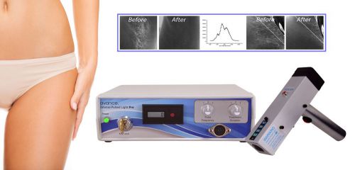 IPL Pulsed Light Permanent Hair Removal Laser Machine, for Salon &amp; Doctor Use.