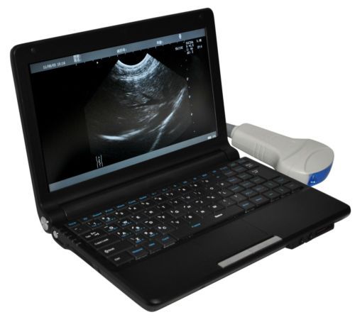 `digital laptop/ultrasound scanner ultrasound systemtrans-vaginal&amp;micro-convex ~ for sale
