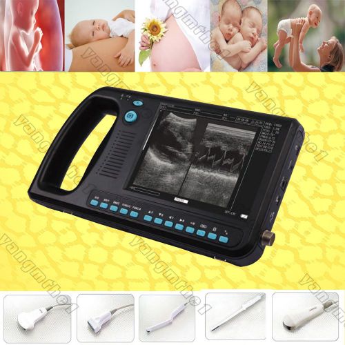 Palm smart b-ultrasound ultrasound scanner system +convex probe, scanner system for sale