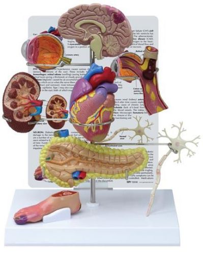 NEW Anatomical Type II Diabetes Complete Model Set