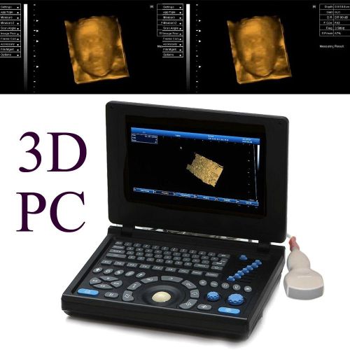Digital laptop ultrasound scanner machine pc platform convex probe build-in 3d for sale