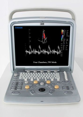 Chison q9 ultrasound system *new* for sale