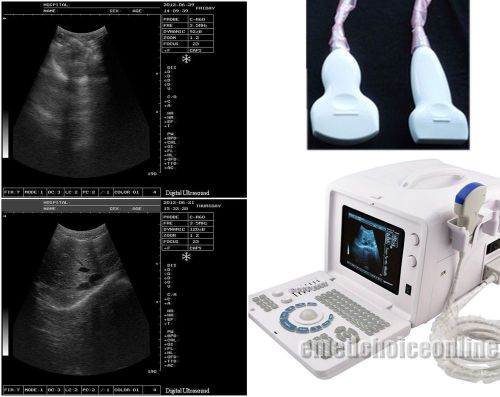 2 probes+3d digital ultrasound scanner+3.5mhz convex 7.5mhz linear probe ce dfa for sale