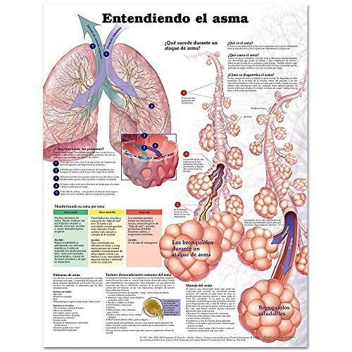 Understanding Asthma Anatomical Chart in Spanish Entendiendo El Asma