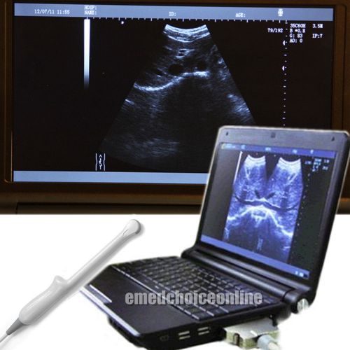 Hot laptop / notebook ultrasound scanner transvaginal probe + newest 3d software for sale