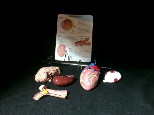 GPI #4000 Hypertension Set: Artery, Brain, Heart, Kidney, Eye Anatomical Model