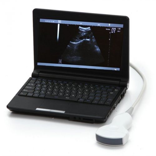 2015 brand new digital laptop ultrasound scanner/machine system + 3.5mhz convex for sale