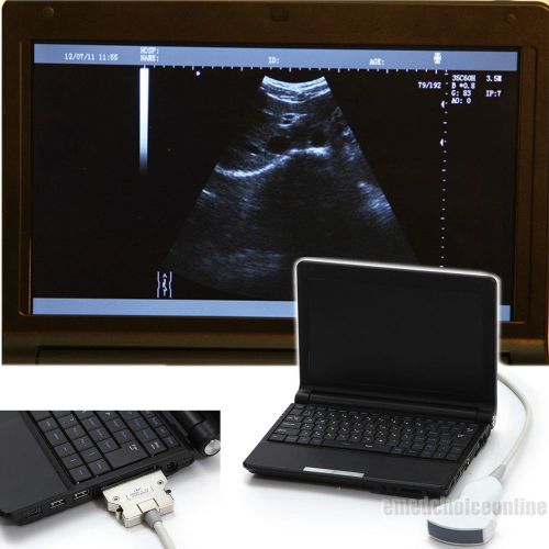 +3d Full Digital Laptop notebook Ultrasound Scanner Machine 3.5MHz Convex Probe
