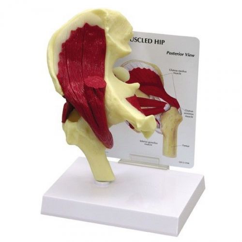NEW Anatomical Human Muscled Hip Joint Model OVERSTOCKED Returned by customer