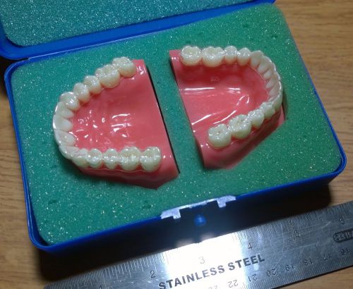invisalign teeth model dental