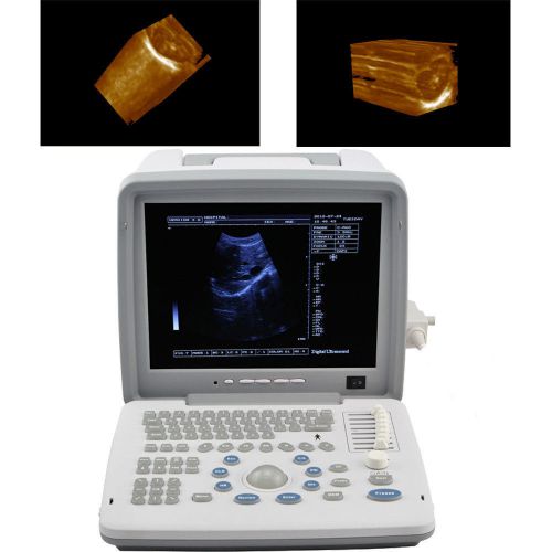 12.1 LED Full Digital Portable Ultrasound Scanner rectal probe 3D workstation CE