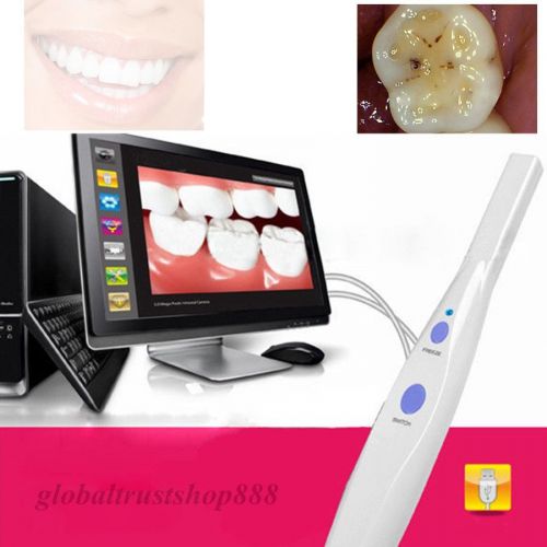 Sales Promotion 2015 New 5.0 MP USB Intraoral Oral Dental Camera HK790 US