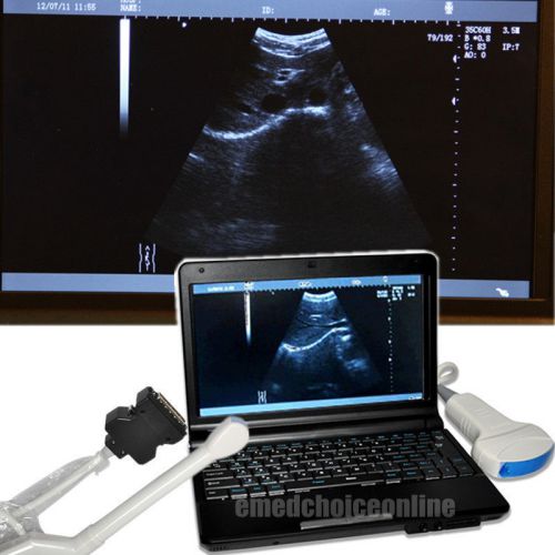 HOT NEW Laptop Digital Ultrasound Scanner Machine + TV + Convex 2 Probes + 3D