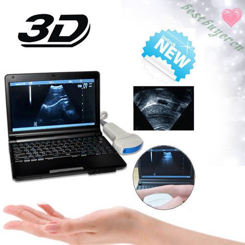 10.1&#039; laptop ultrasound-scanner ultrasound system 3d*linear+ micro-convex! nice for sale