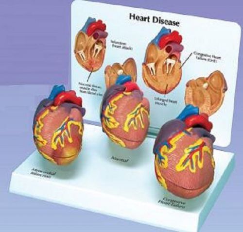 NEW Anatomical 3 Mini Heart Disease Set Model