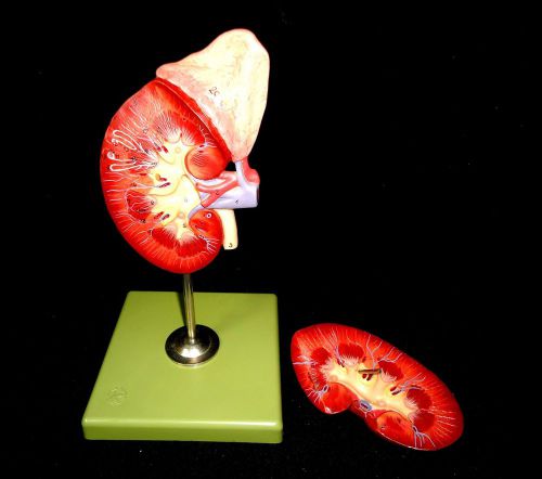 SOMSO LS1 Right Kidney &amp; Adrenal Gland Anatomical Model on Base (2 parts) LS 1
