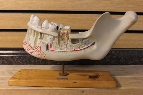 Cenco Anatomical Jaw and Teeth Dentist Model Hand Painted Diagram w. Stand