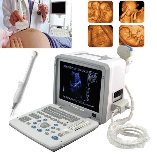 3d full digital portable ultrasound scanner convex &amp; transvaginal 3d workstation for sale
