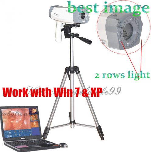Digital electronic colposcope sony camera gynecology +win 7/xp software +tripod for sale