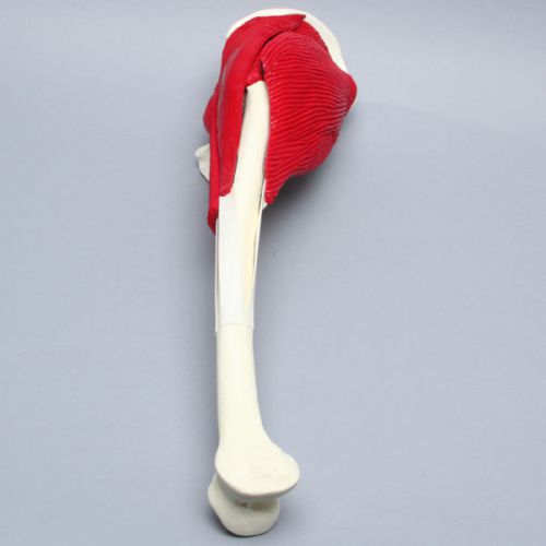 Sawbones Hip with Erosion, Muscles, and Torn Labrum 1174-28 New Prop Medical