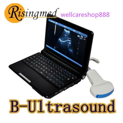 Ultrasound Scanner Digital Mobile Diagnostic + Convex Probe+3D all-sided tool