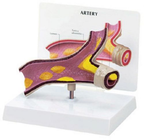 Anatomical Human Artery Oversized &#034;Y&#034; Section Model OVERSTOCKED RETURNED