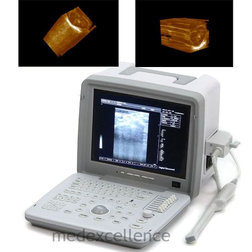 New 12.1 full digital portable ultrasound scanner trans vaginal 3d workstation for sale