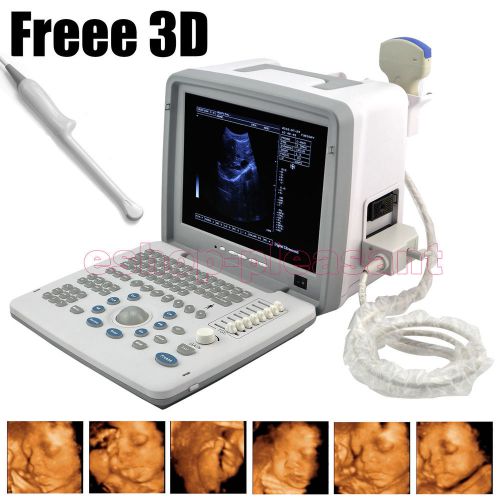 Digital portable ultrasound scanner machine+convex&amp;vaginal 2probes+newest produc for sale