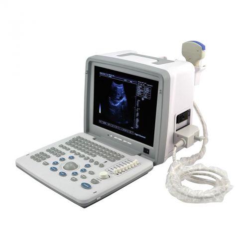Ce proved full digital portable ultrasound scanner + convex probe+3d software for sale