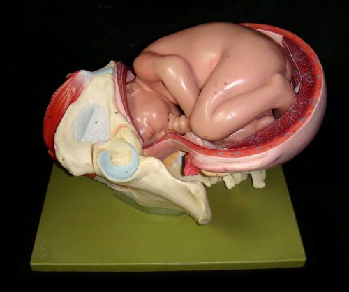 SOMSO MS45-1 Pelvic, Baby First Stage of Birthing Anatomical Model MS 45-1