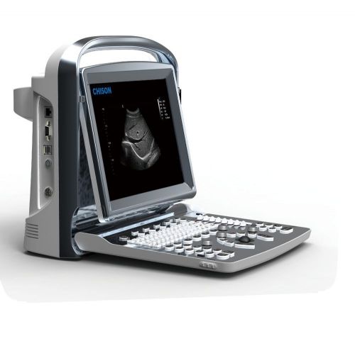 Chison eco1 ultrasound system *new* for sale