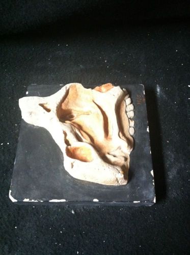 Antique Plaster Anatomical Bone Model