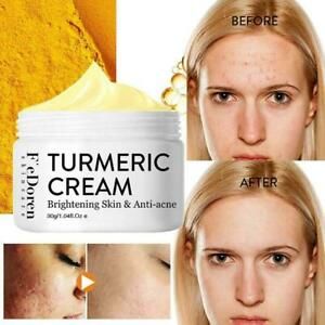 Vitamin C Brightening Hydrating Serum Moisturizing Cream P5X0