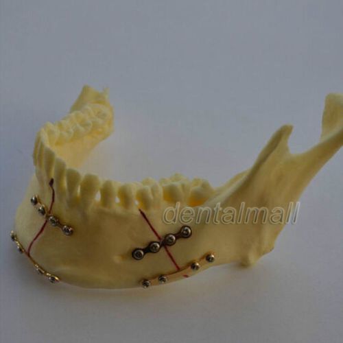 New Dental Model #5001 02 - Lower Jaw Model with Fixation